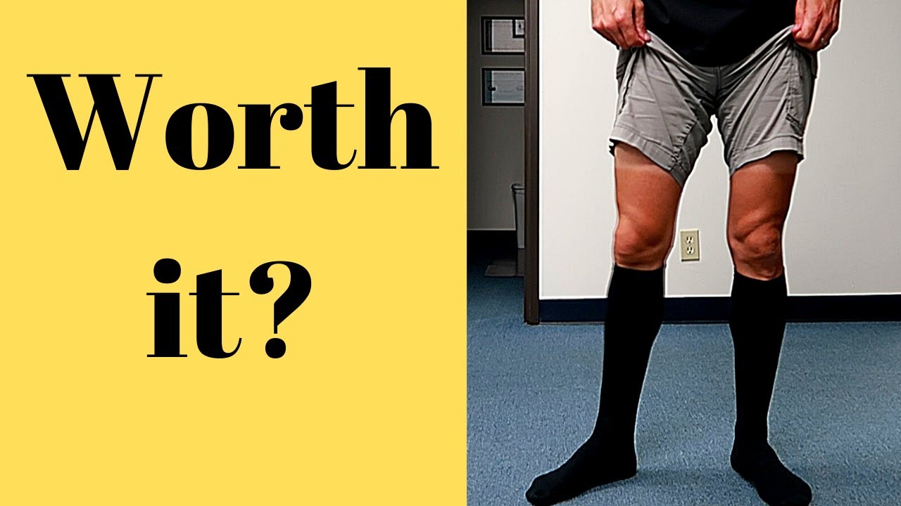 Compression Socks: Should you use them? 🤷♀️👈