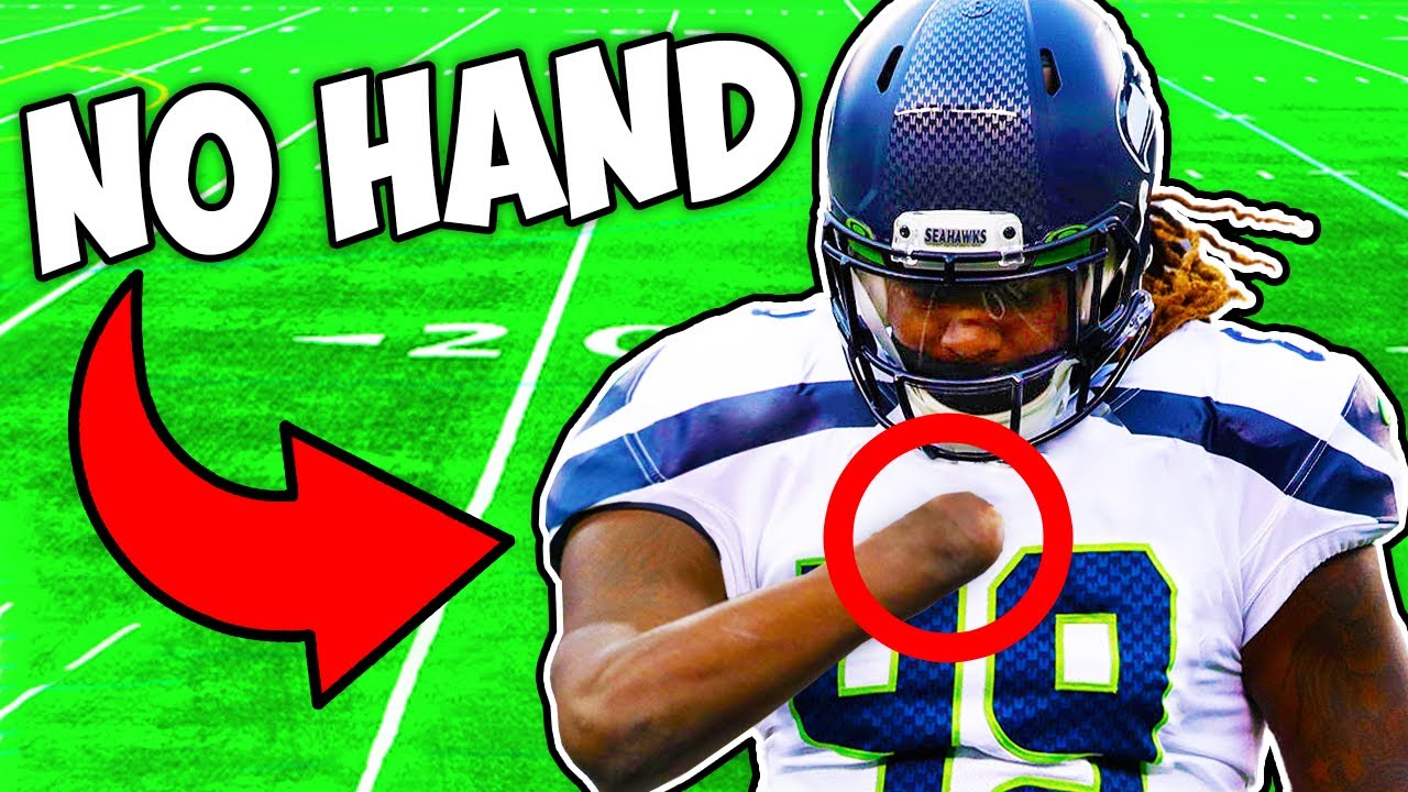 THIS NFL PLAYER ONLY HAS ONE HAND..