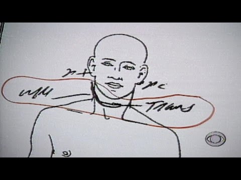 From the archives: Autopsy photos shown to O.J. Simpson jury