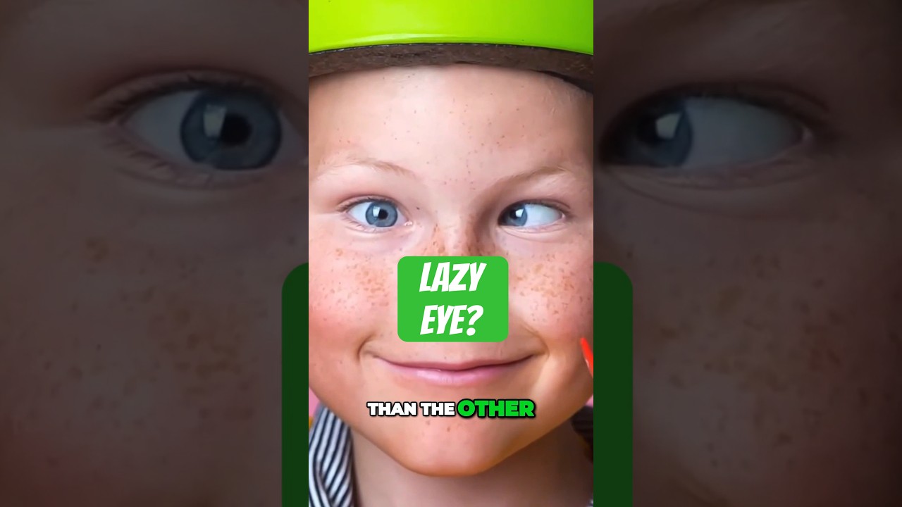 The Truth About Lazy Eye: Debunking the Misconceptions #lazyeye #amblyopia #optometry
