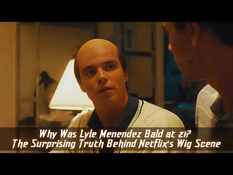 Why Was Lyle Menendez Bald at 21? The Surprising Truth Behind Netflix’s Wig Scene!